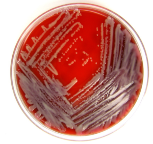 Stenotrophomonas maltophilia