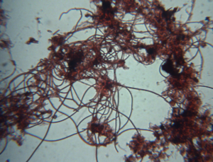 Filamentous Bacteria