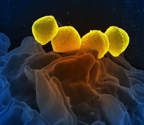 heterotrophic bacteria