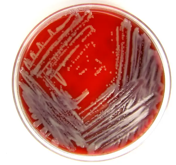 Stenotrophomonas Maltophilia Ask Microbiology   Stenotrophomonas Maltophilia Culture 