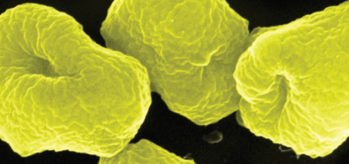 archaea