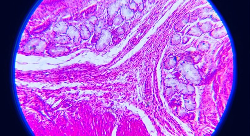 Cell Homogenizers: Techniques, Uses, and Best Practices in Microbial Analysis