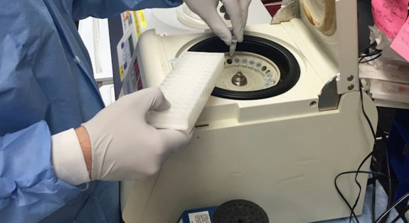 Gel Centrifuge: Principles, Uses, and Maintenance in Microbiology Labs