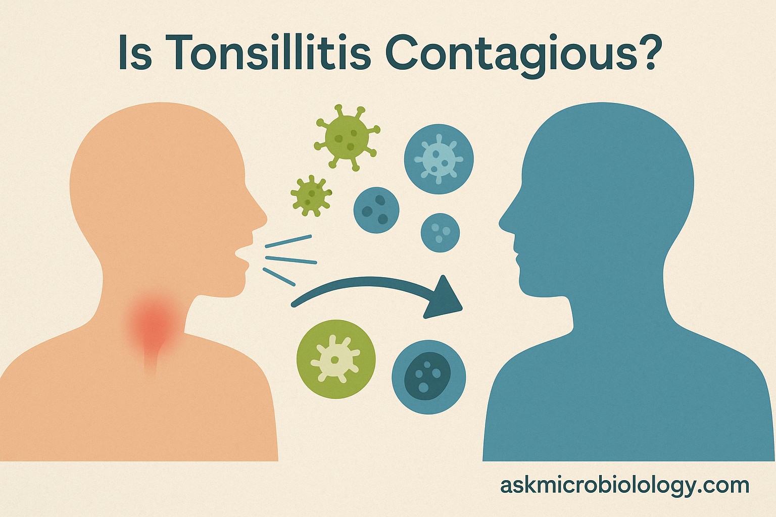 Viral vs bacterial tonsillitis illustration showing droplet spread and throat infections